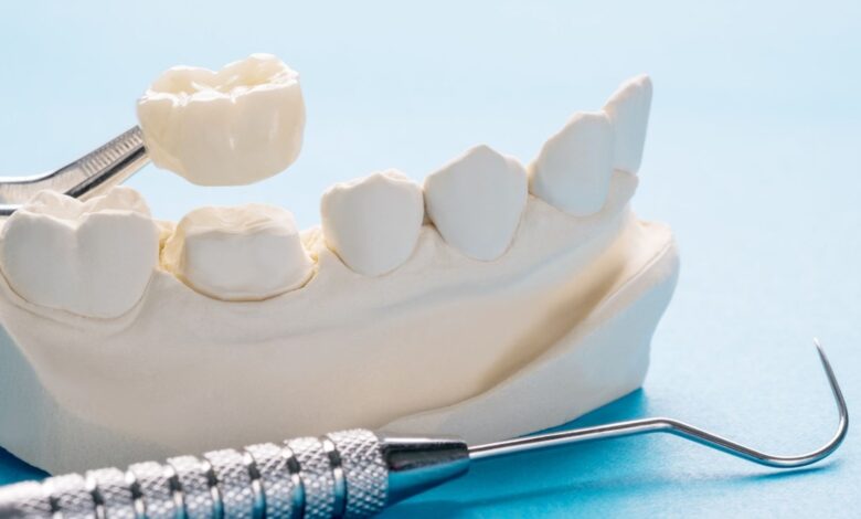 The Advantages of Ceramic Fillings and Crowns in Cosmetic Dentistry
